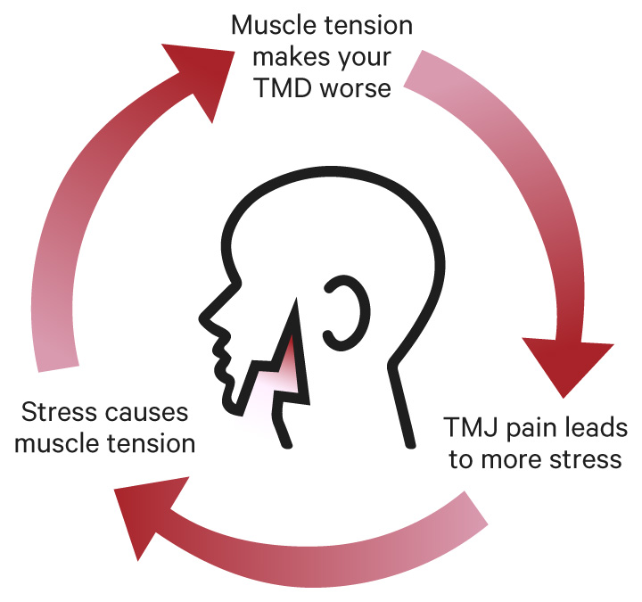 Illustration showing the pain cycle of stress and TMD.