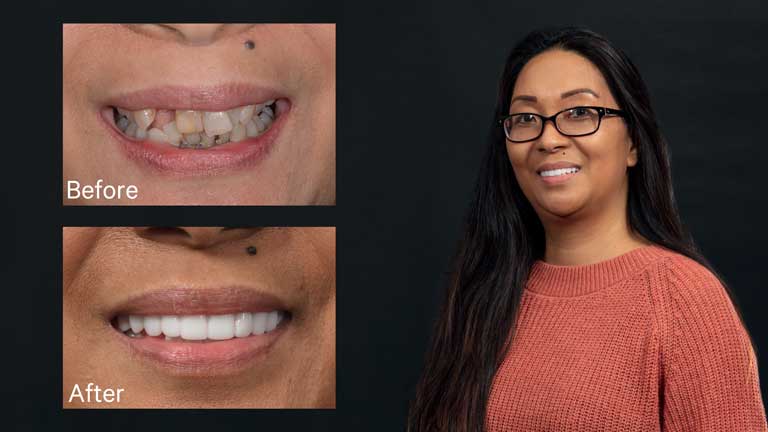 Infinite Smiles client, Remellee, talks about her experiences with a before and after photo shown at the side.