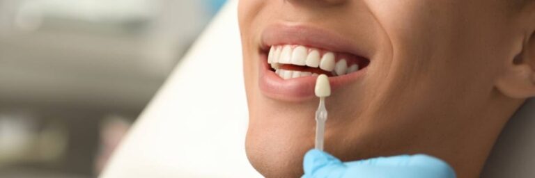 A young man considering dental veneers