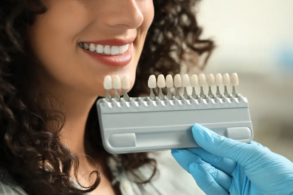 Tooth color testing for crown placement