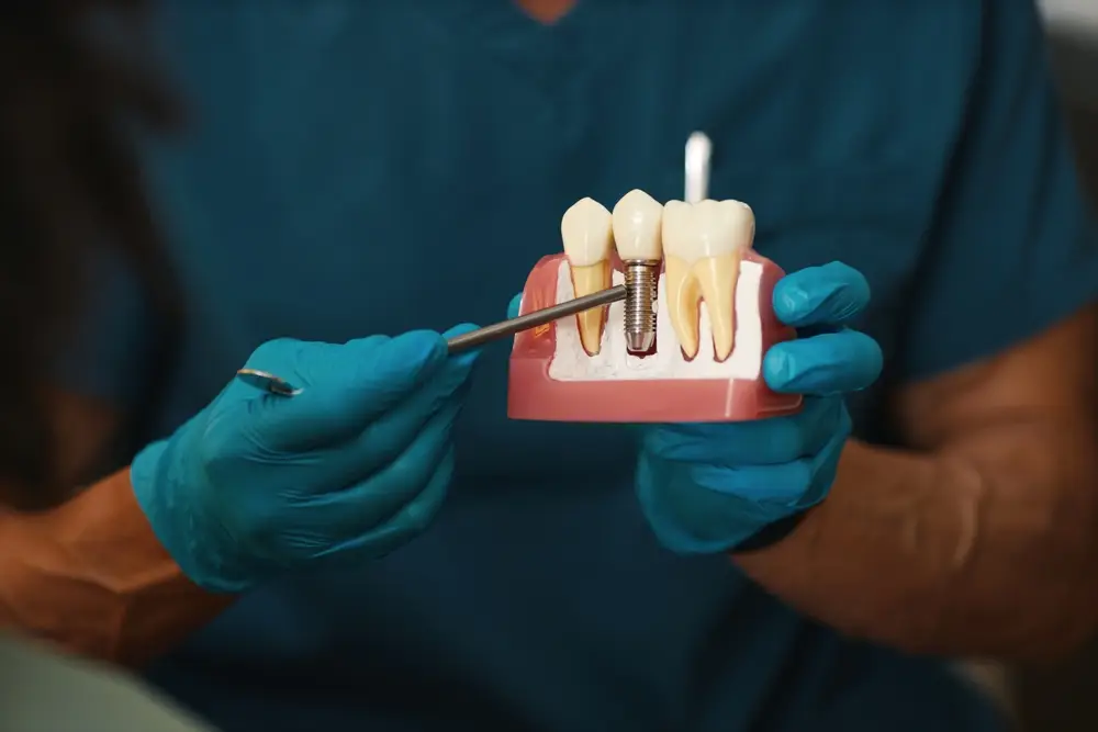 A dentist demonstrating how dental implants work